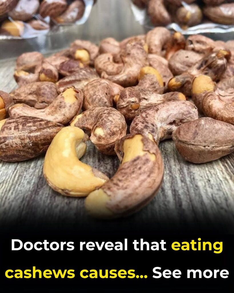Doctors Reveal That Eating Cashews Causes Remarkable Changes in Your Body – welcome